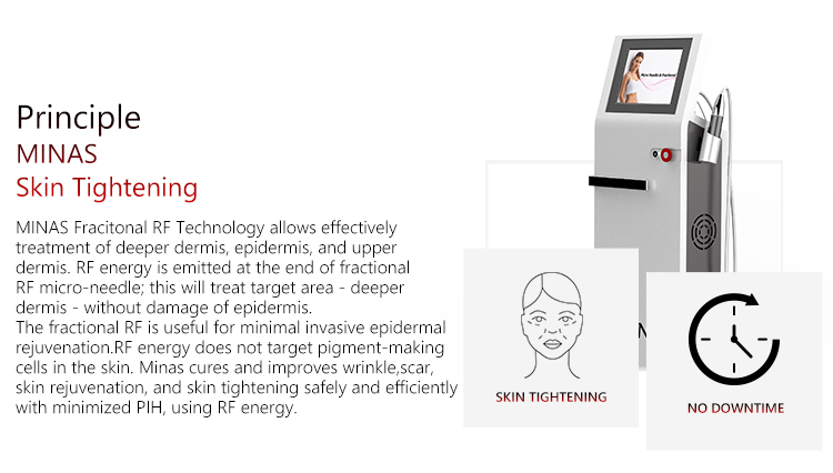 Minas TM50B Gold Microneedle RF Face Lifting Machine Price Manufacture