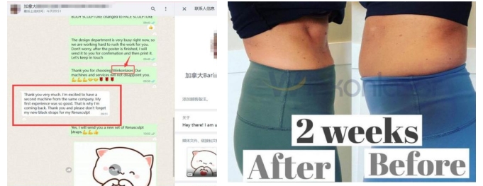 renasculpt before and after