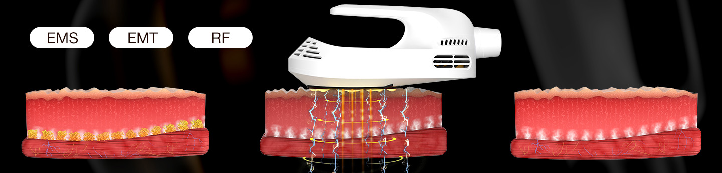 Professional clinical environment featuring the Renasculpt FE60 body shaping machine