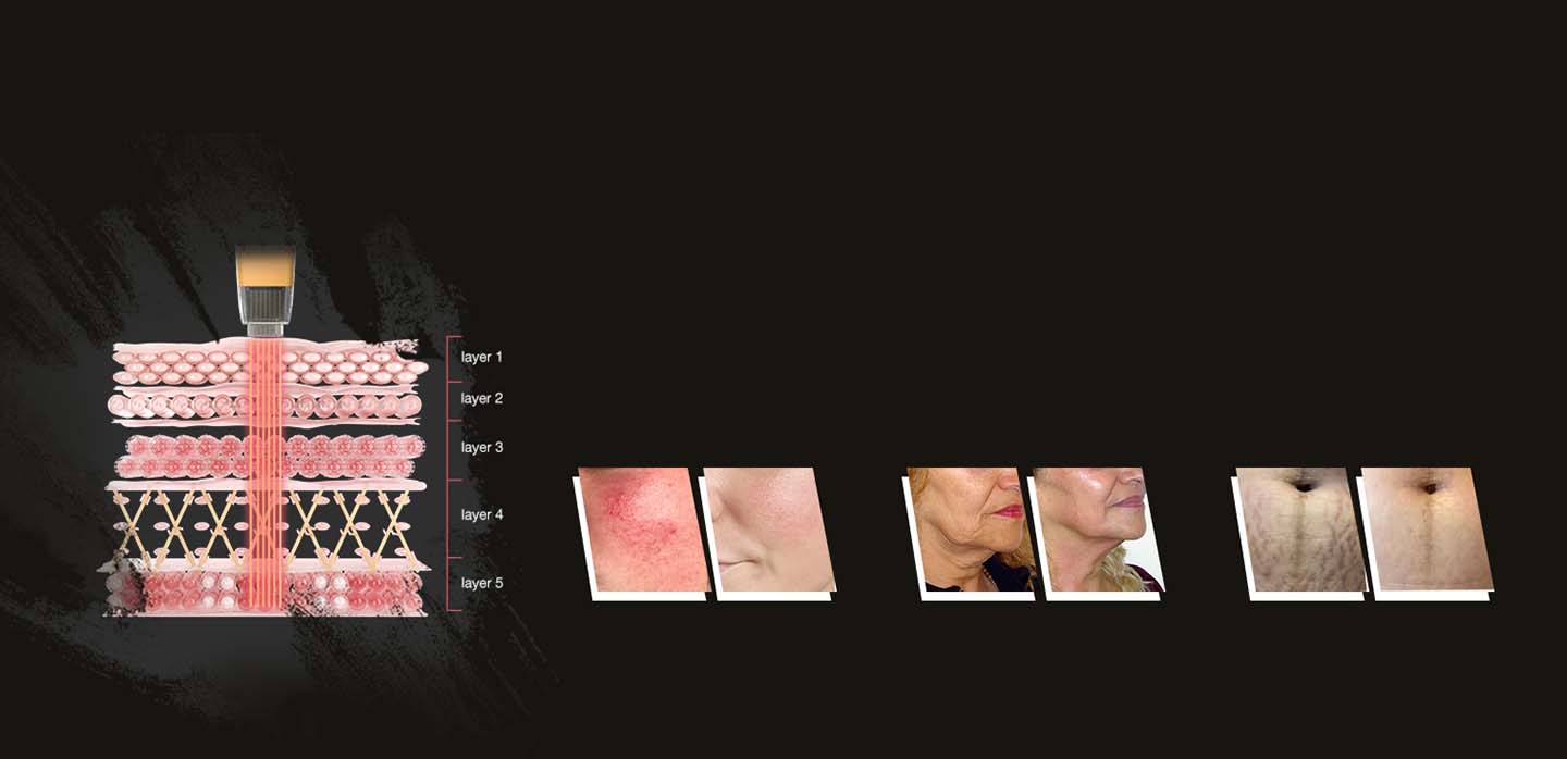 Operational Excellence