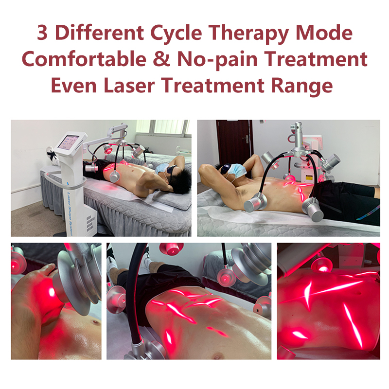 Renaslim Z6 Lipo Laser 650Nm Red Bule Light Therapy Body Slimming Sculpt Machine Price Manufacture