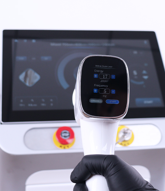 AresLite DM60 3000W AI Diode Laser Hair Removal Machine Professional